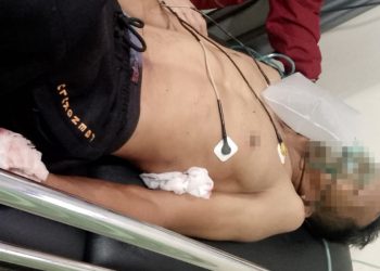 Ditusuk 3 Liang, Satpam DPRD Provinsi Bengkulu Bercucuran Darah