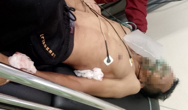 Ditusuk 3 Liang, Satpam DPRD Provinsi Bengkulu Bercucuran Darah