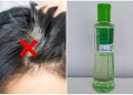 Ajaib, Ternyata Uban Bisa Hilang dengan Minyak Kayu Putih, Begini Caranya