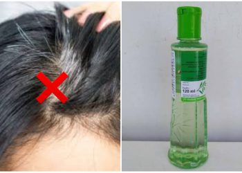 Ajaib, Ternyata Uban Bisa Hilang dengan Minyak Kayu Putih, Begini Caranya