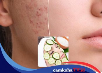 Rahasia Kecantikan Alami, 7 Bahan Alami Ini Bisa Bantu Atasi Jerawat, Yuk Coba