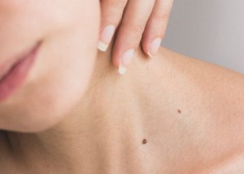 10 Arti Tahi Lalat di Leher Menurut Primbon Jawa, Apa Benar Sosok yang Pemalas?