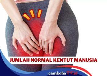Kentut 14 Kali Sehari, Normal atau Tidak? Ini Penjelasannya