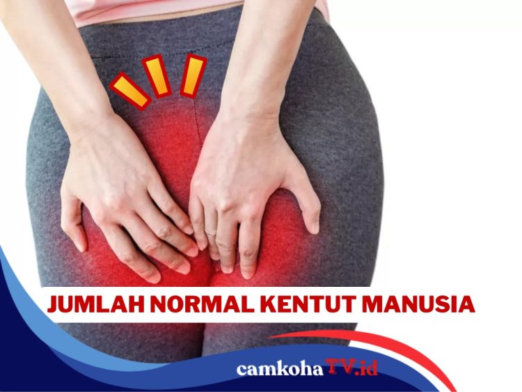 Kentut 14 Kali Sehari, Normal atau Tidak? Ini Penjelasannya
