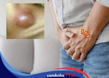 Kenali Ciri-cirinya, Berikut Gejala HIV pada Pria yang Perlu Diwaspadai