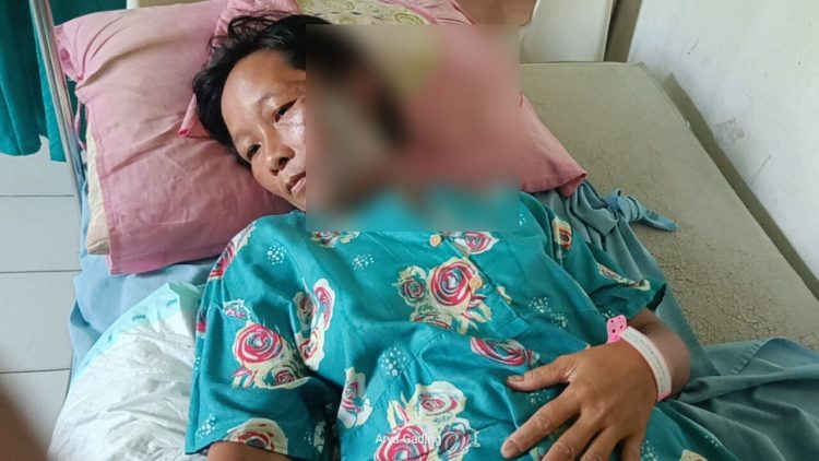 Di Bengkulu Ada Suami Tega Siram Air Panas ke Wajah Istri Hingga Melepuh