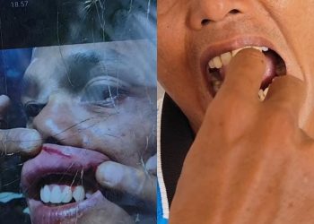 Usai Shalat Berjamaah, Warga Kampung Melayu Berkelahi di Halaman Masjid