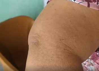 Petugas Koperasi Mengaku Dikeroyok Saat Tagih Angsuran Pinjaman