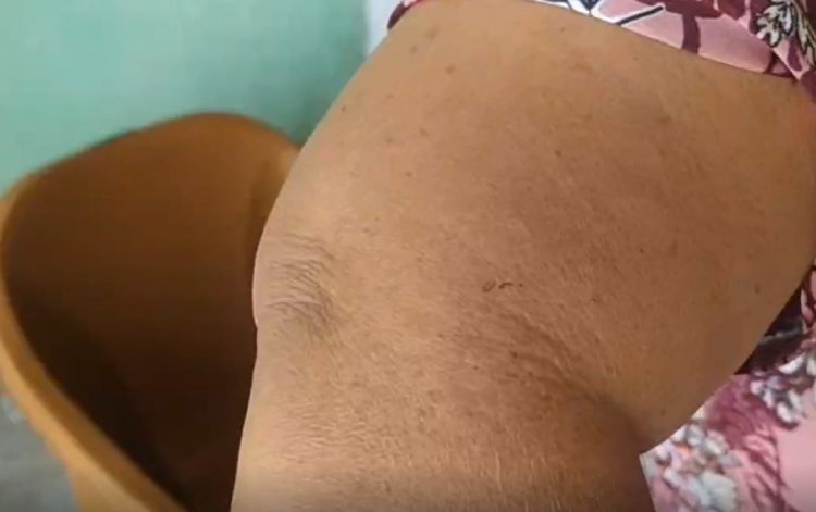 Petugas Koperasi Mengaku Dikeroyok Saat Tagih Angsuran Pinjaman