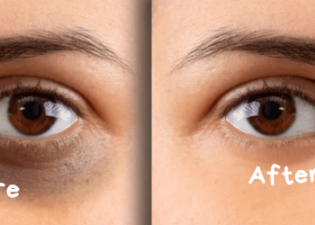 Cara Menghilangkan Mata Panda, Bikin Wajah Lebih Segar