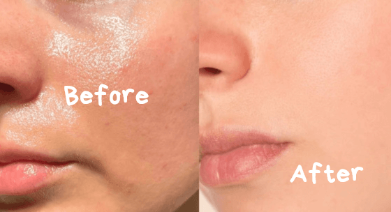 Rahasia Kecantikan Alami, Ini Cara Mengatasi Wajah Berminyak, Buktikan Sendriri