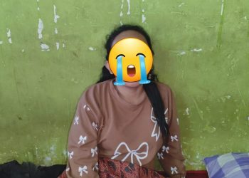Wanita Kelurahan Kandang Mas Lebam di Wajah, Begini Pengakuannya