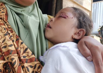 Anjing Liar Teror Warga Arma Jaya, Bocah 4 Tahun Terluka, Belasan Kambing Jadi Korban